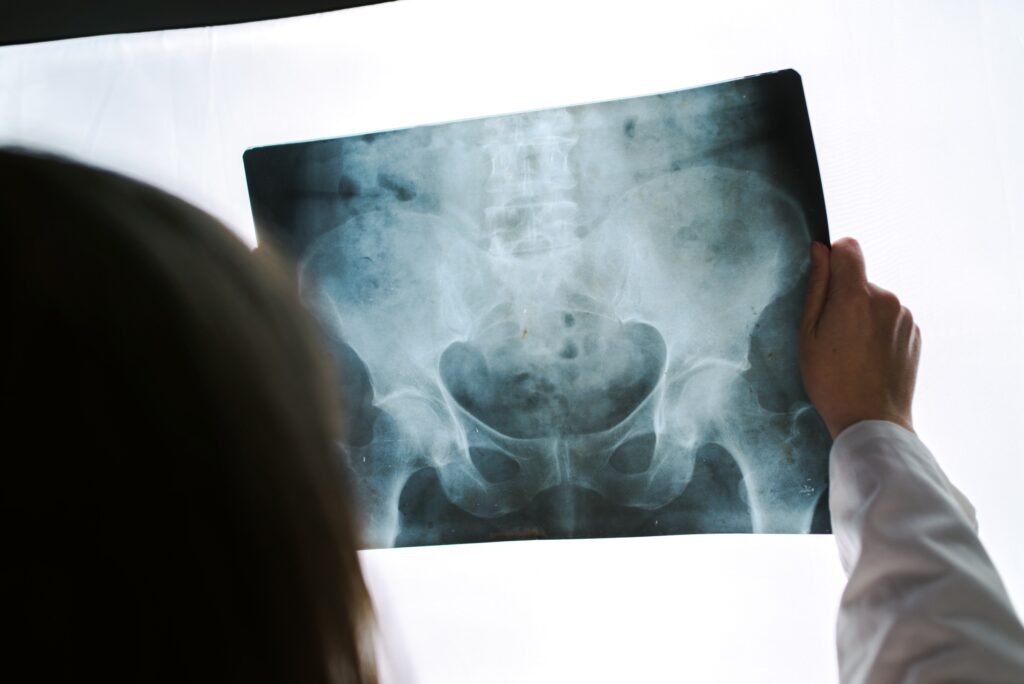 A doctor interpreting an X-ray resulting in delayed treatment
